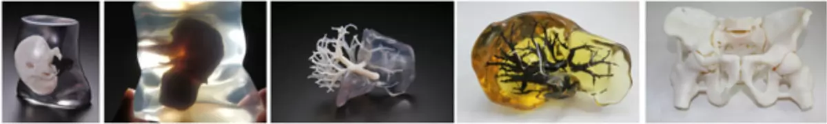 3D Printing Medical Product 