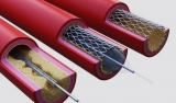 How to Manufacture Medical Stent: The Methods of Stent Manufacture