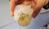 Valve Stent: Basics, Applications, and Advancements